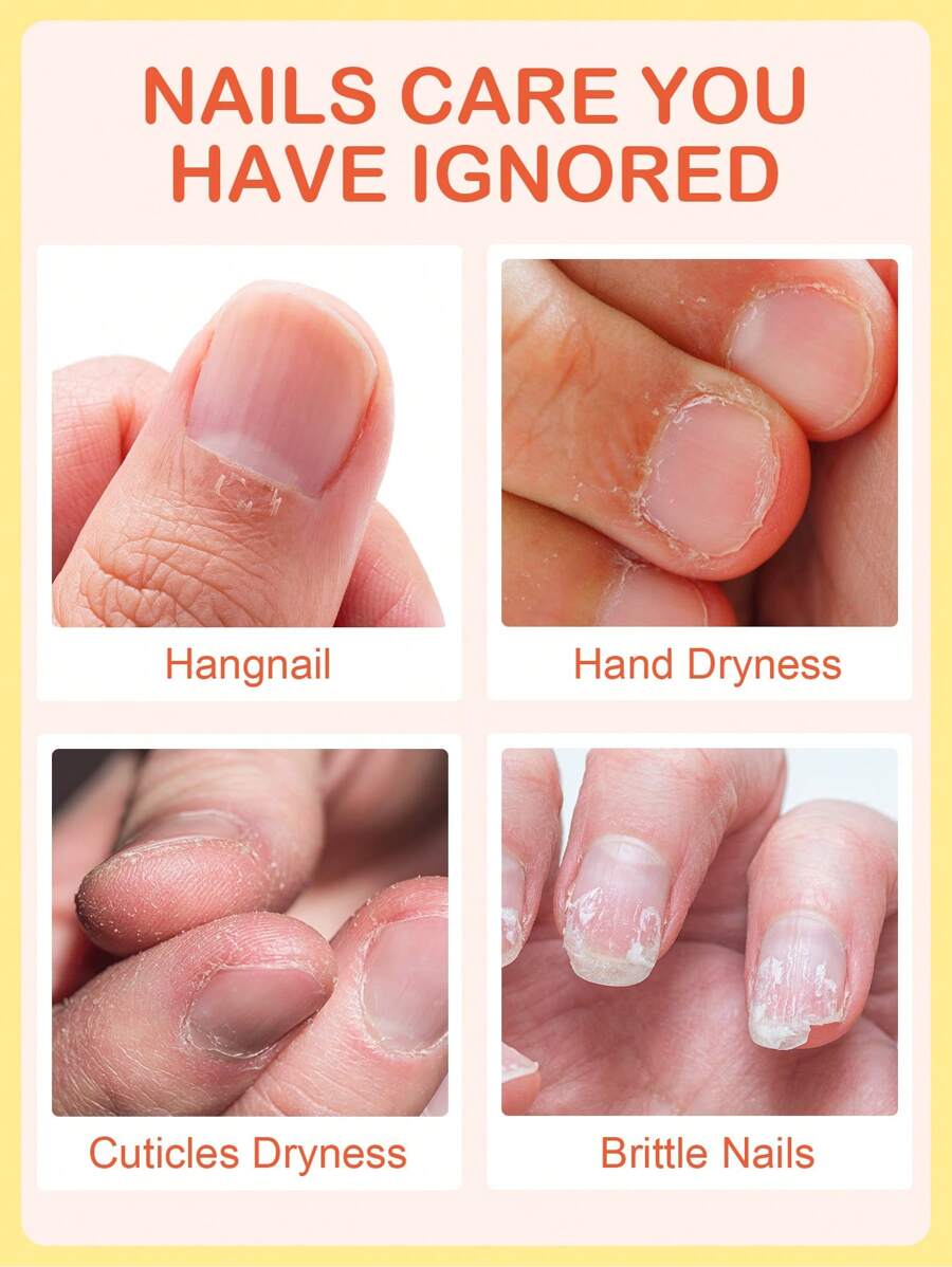 **SlowSunday Vitamin E Cuticle Oil** – With Olive & Grape Seed Oils, Portable Nail & Body Care for Fall/Winter